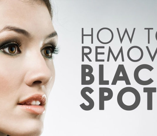 Natural Ways To-Reduce-Black-Spots